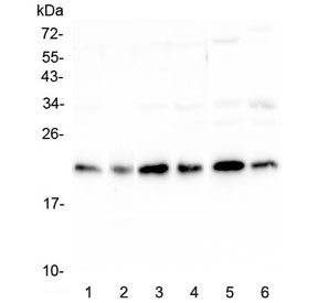 Western blot testing of human 1) HeLa, 2) placenta, 3) HepG2, 4) MCF7, 5) mouse testis and 6) mouse brain lysate with RKIP antibody at 0.5ug/ml. Predicted molecular weight ~21 kDa.