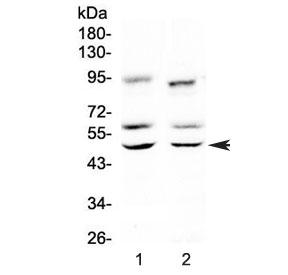 Western blot testing of 1) rat brain and 2) mouse brain lysate with CAMK2A antibody at 0.5ug/ml. Predicted molecular weight: ~54 kDa. An additional ~65 kDa band is often observed.