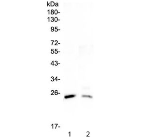Western blot testing of 1) rat testis and 2) mouse testis lysate with StAR antibody at 0.5ug/ml. Expected molecular weight ~37 kDa (preprotein), ~30 kDa (mature form).