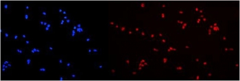 Immunofluorescent staining of FFPE human U-2 OS cells with HNRNPA2B1 antibody (red) at 2ug/ml and DAPI nuclear stain (blue). HIER: steam section in pH6 citrate buffer for 20 min.