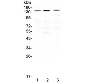 Western blot testing of human 1) HeLa, 2) SGC-7901 and 3) THP-1 cell lysate with TrkA antibdoy at 0.5ug/ml. Expected molecular weight: 85~140 kDa depending on glycosylation level.