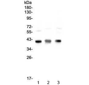 Western blot testing of 1) rat thymus, 2) mouse thymus and 3) mouse NIH 3T3 lysate with CCR4 antibody at 0.5ug/ml. Predicted molecular weight ~41 kDa.