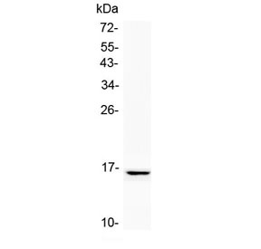 Western blot testing of human SK-OV-3 cell lysate with NPC2 antibody at 0.5ug/ml. Predicted molecular weight: ~17 kDa, can be observed as a ~21/23 kDa doublet in human samples. (Ref 1).