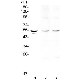 Western blot testing of 1) human SGC-7901, 2) rat heart and 3) mouse heart lysate with TPH1 antibody at 0.5ug/ml. Predicted molecular weight ~51 kDa.