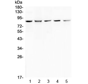 Western blot testing of human 1) HeLa, 2) 293T, 3) COLO-320, 4) SW620 and 5) MCF7 cell lysate with RNF43 antibody at 0.5ug/ml. Predicted molecular weight: ~86 kDa (isoform 1), ~95 kDa (isoform 4).