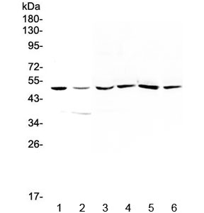 Western blot testing of 1) human HepG2, 2) human A549, 3) rat liver, 4) rat kidney, 5) mouse liver and 6) mouse kidney tissue with HGD antibody at 0.5ug/ml. Predicted molecular weight ~50 kDa.