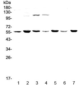Western blot testing of human 1) HeLa, 2) MDA-MB-453, 3) Jurkat, 4) HepG2, 5) SK-OV-3, 6) PANC-1 and 7) mouse thymus lysate with CHRNA3 antibody at 0.5ug/ml. Predicted molecular weight ~57 kDa.