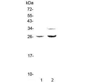 Western blot testing of rat 1) PC-12 and 2) RH35 lysate with Betacellulin antibody at 0.5ug/ml. Expected molecular weight: 20-40 kDa depending on glycosylation level.