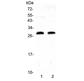 Western blot testing of 1) rat heart and 2) rat lung lysate with C-Reactive Protein antibody at 0.5ug/ml. Predicted molecular weight ~26 kDa.
