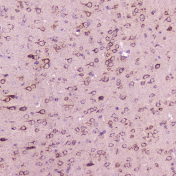 IHC testing of FFPE mouse brain with Calcitonin antibody at 2ug/ml. HIER: steamed antigen retrieval with pH6 citrate buffer.