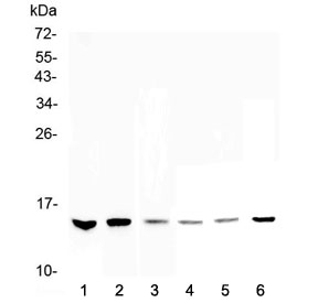 Western blot testing of 1) human HeLa, 2) human MDA-MB-231, 3) human MDA-MB-451, 4) rat thymus, 5) mouse testis and 6) mouse thymus lysate with HE4 antibody at 0.5ug/ml. Predicted molecular weight: 13-25 depending on glycosylation level.