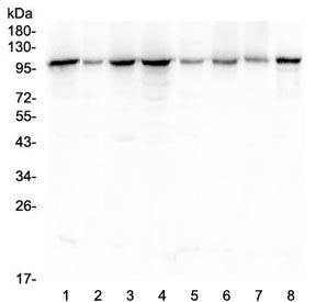 Western blot testing of human 1) HeLa, 2) placenta, 3) COLO-320, 4) SGC-7901, 5) HepG2, 6) K562, 7) Jurkat and 8) SK-OV-3 lysate with HSP105 antibody at 0.5ug/ml. Expected molecular weight: 105-110 kDa.