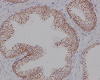IHC testing of FFPE human prostate with Beta 2 Adrenergic Receptor antibody at 2ug/ml. HIER: steamed antigen retrieval with pH6 citrate buffer.