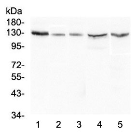 Western blot testing of human 1) HeLa, 2) A549, 3) 22RV1, 4) HepG2 and 5) Caco-2 lysate with CASR antibody at 0.5ug/ml. Predicted molecular weight ~121 kDa, but is routinely observed at up to ~160 kDa.