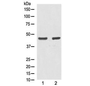 Western blot testing of human 1) A431 and 2) MCF7 lysate with Alpha Actin antibody at 0.5ug/ml. Expected molecular weight: 42-45 kDa.