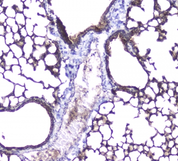 IHC staining of FFPE mouse lung with AQP5 antibody at 1ug/ml. HIER: boil tissue sections in pH6, 10mM citrate buffer, for 10-20 min followed by cooling at RT for 20 min.