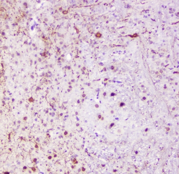 IHC staining of FFPE mouse brain with Calbindin antibody at 1ug/ml. HIER: boil tissue sections in pH6, 10mM citrate buffer, for 10-20 min followed by cooling at RT for 20 min.