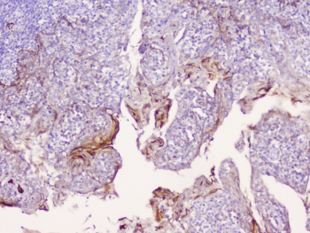 IHC staining of FFPE human tonsil tissue with CD1b antibody at 1ug/ml. HIER: boil tissue sections in pH6, 10mM citrate buffer, for 10-20 min followed by cooling at RT for 20 min.