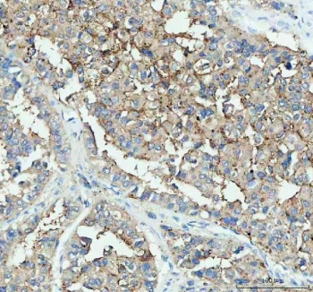 IHC staining of FFPE human liver tissue with DDT antibody. HIER: boil tissue sections in pH8 EDTA for 10-20 min followed by cooling at RT for 20 min.