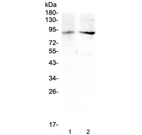 Western blot testing of 1) rat testis and 2) mouse testis lysate with XPB antibody at 0.5ug/ml. Predicted molecular weight ~89 kDa.