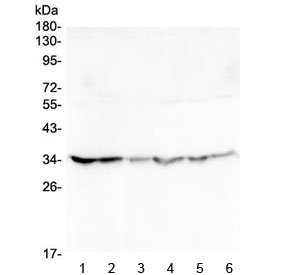 Western blot testing of human 1) HeLa, 2) placenta, 3) U-2 OS, 4) Caco-2, 5) SW620 and 6) A549 lysate with GOLPH3 antibody at 0.5ug/ml. Predicted molecular weight ~34 kDa.
