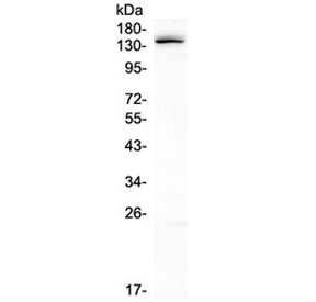 Western blot testing of human K562 cell lysate with LATS1 antibody at 0.5ug/ml. Expected molecular weight: 127-150 kDa.