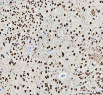IHC staining of FFPE mouse brain tissue with NOVA1 antibody. HIER: boil tissue sections in pH8 EDTA for 20 min and allow to cool before testing.