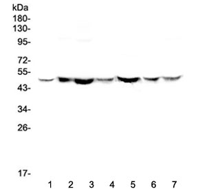 Western blot testing of human 1) HeLa, 2) placenta, 3) A549, 4) MDA-MB-453, 5) SW620, 6) 22RV1 and 7) SW579 with TANK antibody at 0.5ug/ml. Expected molecular weight ~48 kDa.