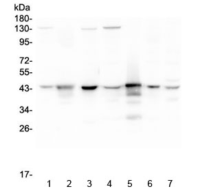 Western blot testing of human 1) HeLa, 2) placenta, 3) A549, 4) MCF7, 5) U-937, 6) U-2 OS and 7) Caco-2 lysate with ADA antibody at 0.5ug/ml. Predicted molecular weight ~41 kDa.