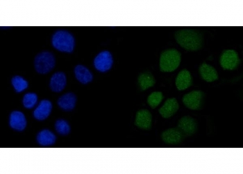 Immunofluorescent staining of FFPE human A431 cells with Anillin antibody (green) and DAPI nuclear stain (blue). HIER: steam section in pH6 citrate buffer for 20 min.