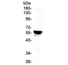 Western blot testing of human placenta lysate with CYP19A1 antibody at 0.5ug/ml. Predicted molecular weight ~58 kDa.