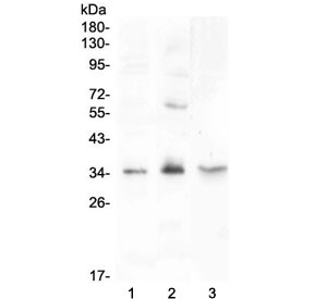 Western blot testing of 1) rat testis, 2) rat PC-12 and 3) mouse testis lysate with FGF23 antibody at 0.5ug/ml. Predicted molecular weight: 28-32 kDa.