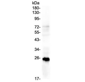 Western blot testing of human T-47D lysate with PGF antibody at 0.5ug/ml. Expected molecular weight: 19-28 kDa depending on glycosylation level.