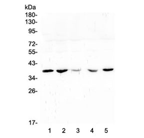 Western blot testing of human 1) placenta, 2) U-2 OS, 3) A431, 4) HeLa and 5) A549 lysate with uPAR antibody at 0.5ug/ml. Expected molecular weight: 37-60 kDa, depending on glycosylation level.