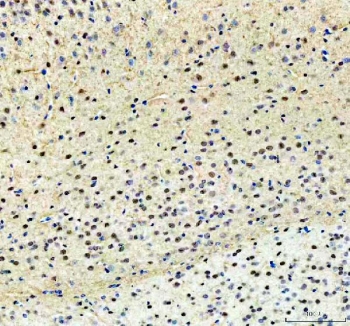 IHC staining of FFPE mouse brain tissue with PKC beta antibody. HIER: boil tissue sections in pH8 EDTA for 20 min and allow to cool before testing.