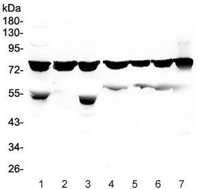 Western blot testing of human 1) K562, 2) THP-1, 3) HEK293, 4) Jurkat, 5) Raji, 6) HL-60 and 7) A549 lysate with PKC beta antibody at 0.5ug/ml. Predicted molecular weight ~76 kDa.