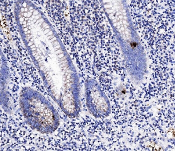 IHC staining of FFPE human appendicitis tissue with Peptide YY antibody at 1ug/ml. HIER: boil tissue sections in pH6, 10mM citrate buffer, for 10-20 min followed by cooling at RT for 20 min.