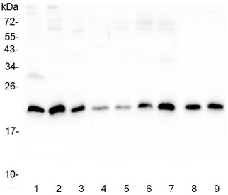 Western blot testing of human 1) placenta, 2) U-2 OS, 3) A431, 4) PC-3, 5) HL-60, 6) K562, 7) Caco-2, 8) rat lung and 9) mouse lung lysate with SRI antibody at 0.5ug/ml. Predicted molecular weight ~22 kDa, routinely observed at 22-29 kDa.