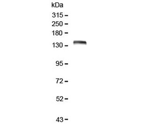Western blot testing of human Caco-2 lysate with LRIG1 antibody at 0.5ug/ml. Expected molecular weight: 119-145 kDa depending on glycosylation level. Soluble fragments of 90-105 kDa and 60-70 kDa may also be observed.