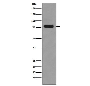 Western blot testing of human 22RV1 lysate with AR-V7 antibody. Predicted molecular weight ~68 kDa but routinely observed at ~80 kDa.