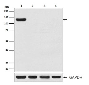 Western blot testing of CRISPR-Cas9 expression in 1) human 293T cell lysate transfected with CRISPR-Cas9, 2) human HEK293, 3) mouse NIH3T3 cell lysate and 4) rat PC12 cell lysate with CRISPR-Cas9 antibody.
