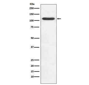 Western blot testing of human Jurkat cell lysate with HIP1 antibody. Predicted molecular weight ~116 kDa.