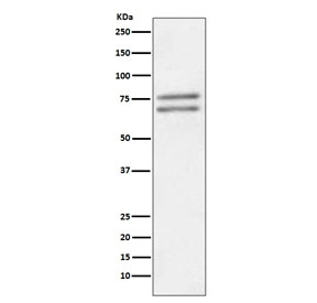 Western blot testing of human Jurkat cell lysate with ADAM10 antibody. Predicted molecular weight: ~84 kDa (full length), ~60 kDa (active form), ~80 kDa (glycosylated active form), ~110 kDa (glycosylated full length).