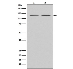 Western blot testing of human 1) HeLa and 2) MCF7 cell lysate with APAF1 antibody. Predicted molecular weight ~140 kDa.