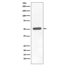 Western blot testing of lysate from human HEK293 cells treated with Calyculin with phospho-Chk1 antibody (pS296). Predicted molecular weight ~54 kDa.