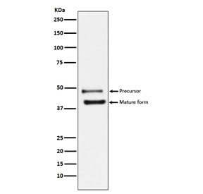 Western blot testing of human HeLa cell lysate with DR5 antibody. Expected molecular weight: ~40 kDa (mature form) and ~48 kDa (precursor). This protein may also be visualized at ~60 kDa.