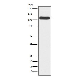 Western blot testing of human A549 cell lysate with OGT antibody. Predicted molecular weight: 110-117 kDa.