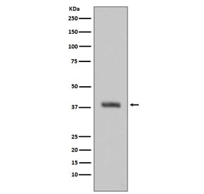 Western blot testing of human HeLa cell lysate with TGN46 antibody. Expected molecular weight: 38-120 kDa depending on glycosylation level.