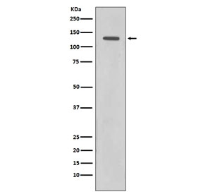 Western blot testing of human HeLa cell lysate with Rad21 antibody. Expected molecular weight: ~120 kDa (full length), 64-70 kDa (cleavage product).
