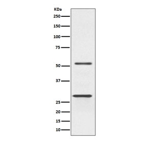 Western blot testing of human Jurkat cell lysate with PARK2 antibody. Expected molecular weight: 50-60 kDa with multiple smaller isoforms (possible ~30 kDa isoform visualized here).